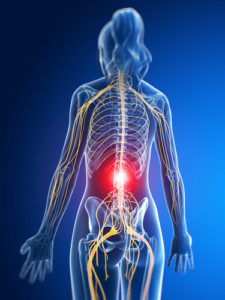 spinal cord stimulation for chronic pain